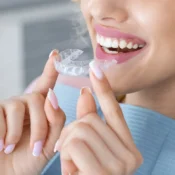 Clear Aligners